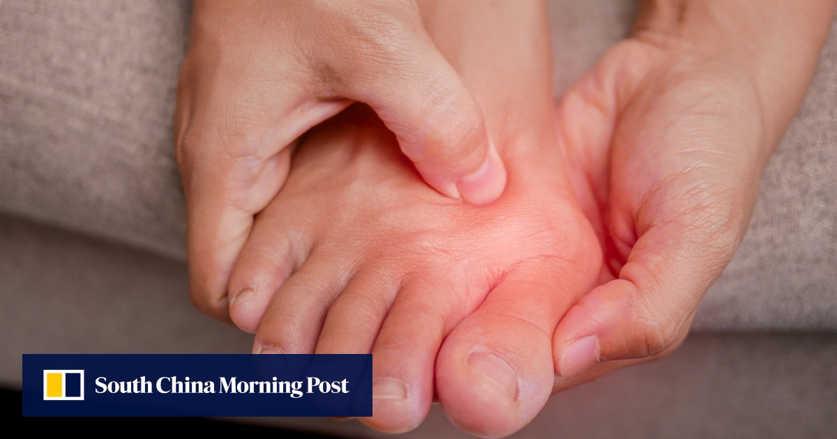 Australian woman admits trying to sell human toes she found in dog vomit