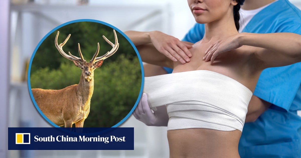 Chinese Woman's Implants Contain Animal DNA, Causes Disability