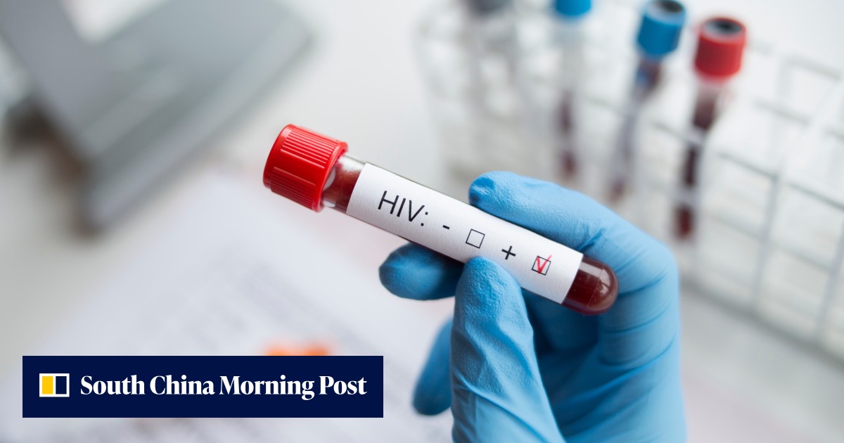 マレーシアの大臣の「ヨロ」の考え方がHIVの症例を駆り立てるという主張はrid笑を引く
