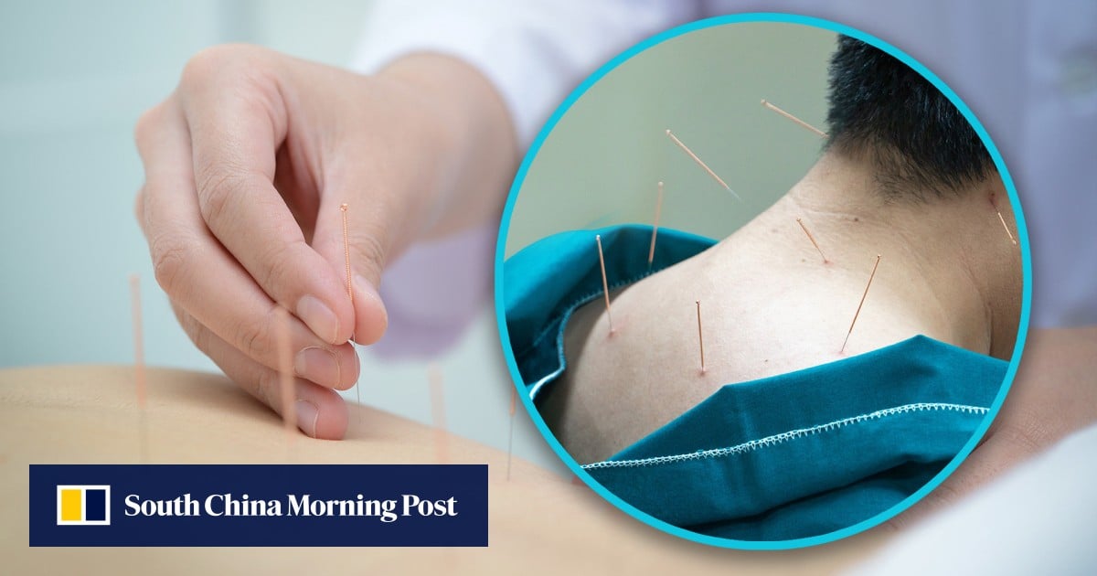 Chinese man visits cybercafe for acupuncture, ends up in ICU with punctured lungs