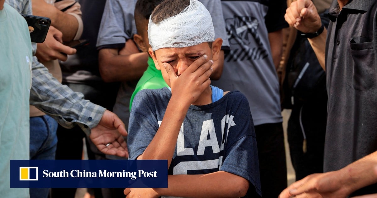 Dozens killed in overnight strikes on southern Gaza city, hospital says
