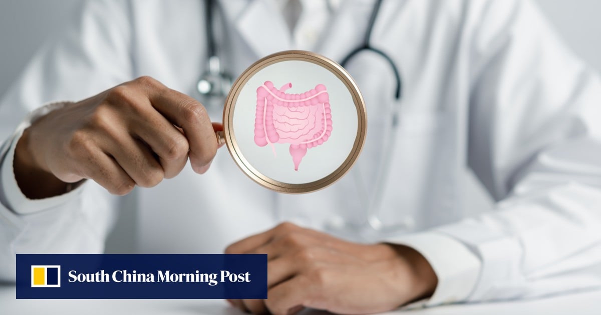 Hong Kong warned of surge in inflammatory bowel disease