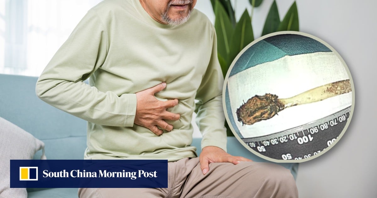 https://cdn.i-scmp.com/sites/default/files/styles/og_image_scmp_generic/public/d8/images/canvas/2025/06/18/06ff6d16-3134-4fe3-a71c-cba8032e10ce_19c54a39.jpg?itok=fM9UOnUi&v=1750234630