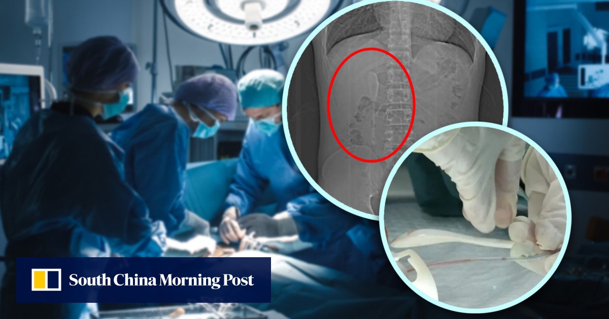 https://cdn.i-scmp.com/sites/default/files/styles/og_image_scmp_generic/public/d8/images/canvas/2025/06/25/92c69af6-42cf-4778-b625-8ed022105d67_00d5674d.jpg?itok=1pzuisxe&v=1750828758