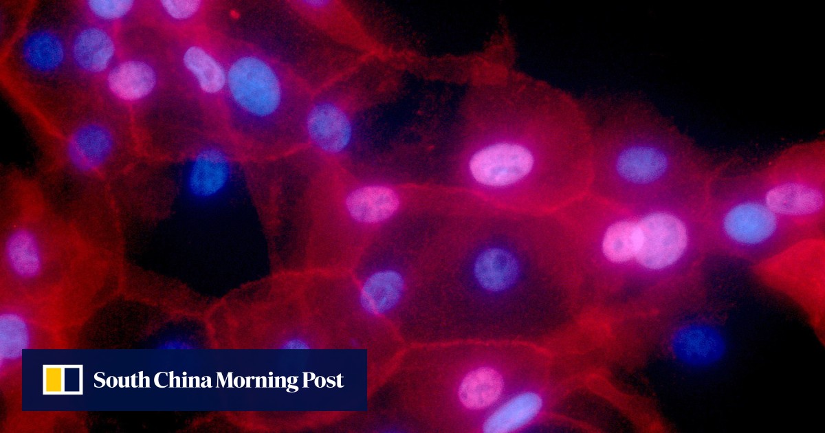 https://cdn.i-scmp.com/sites/default/files/styles/og_image_scmp_generic/public/d8/images/canvas/2025/07/18/356ad038-e8c9-43a3-bdba-ef581431b3fd_29b60dcf.jpg?itok=hI7JH3gQ&v=1752828194
