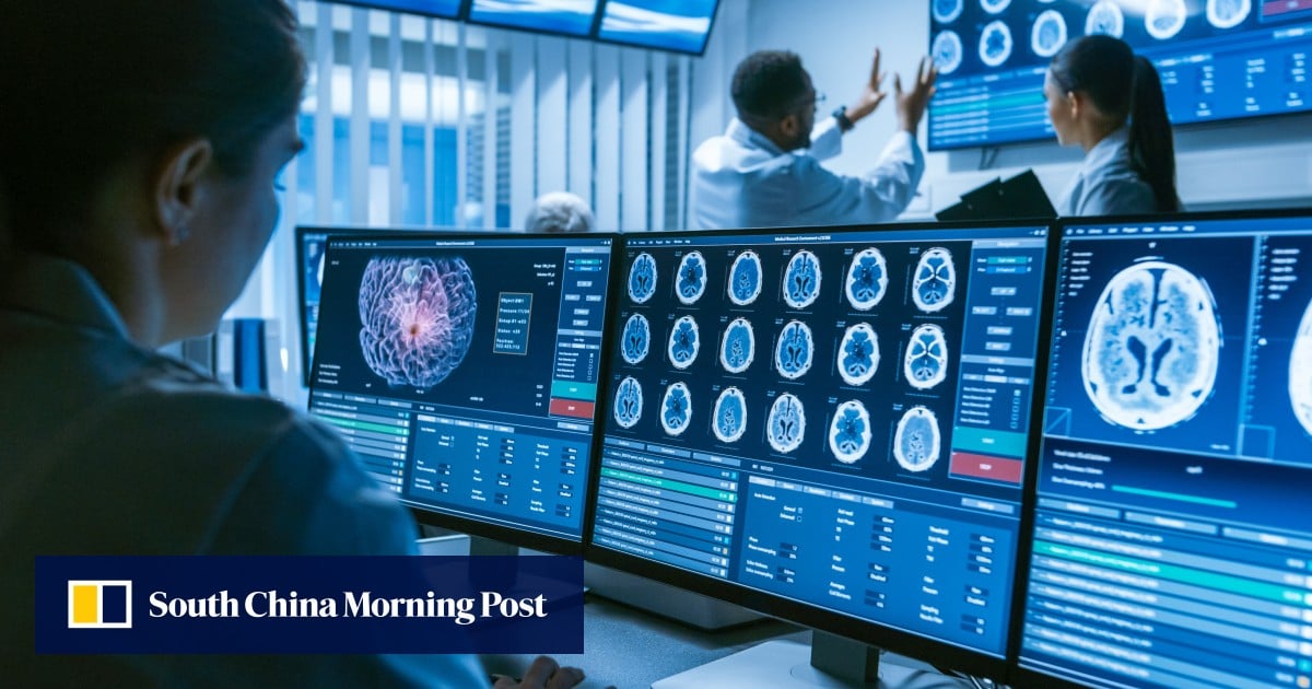 Study Links Irregular Sleep Patterns To 172 Diseases Globally