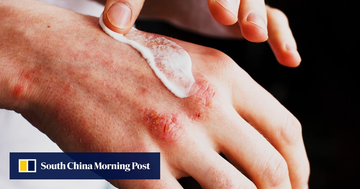 https://cdn.i-scmp.com/sites/default/files/styles/og_image_scmp_generic/public/d8/images/canvas/2025/08/17/fbb3a477-8375-43b8-b9b7-3e0bf6a14cc2_a6879825.jpg?itok=BDWPuCnE&v=1755431912