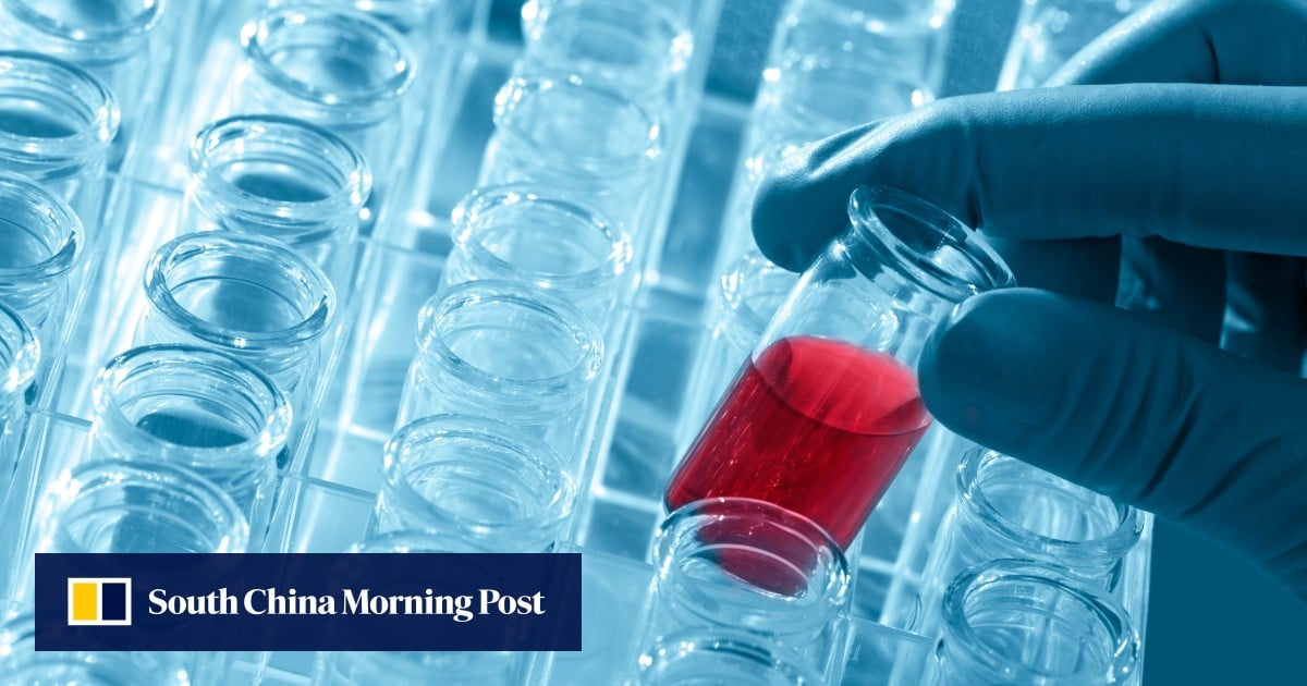 https://cdn.i-scmp.com/sites/default/files/styles/og_image_scmp_generic/public/d8/images/canvas/2025/08/21/3d7d73b5-864a-40c7-bcf6-899b0333ef6c_d8e00d36.jpg?itok=blvjqjj4&v=1755767757