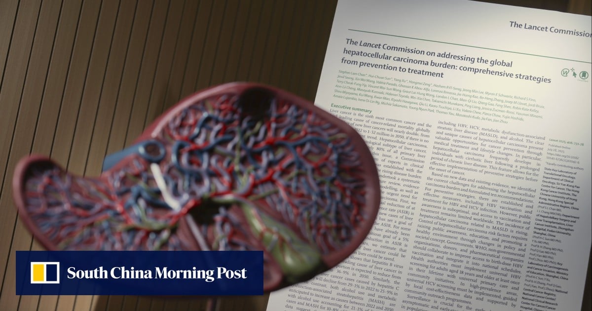 Prevent Liver Cancer Surge: Aussie Experts Back Lifestyle Changes to Avert 2050 Crisis