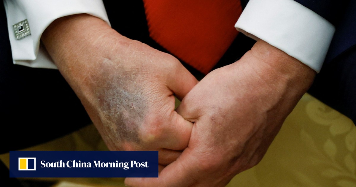 https://cdn.i-scmp.com/sites/default/files/styles/og_image_scmp_generic/public/d8/images/canvas/2025/09/03/bd817563-4ca6-4250-be06-567be6ad5d09_94ace4c7.jpg?itok=EYx6jTVb&v=1756910990