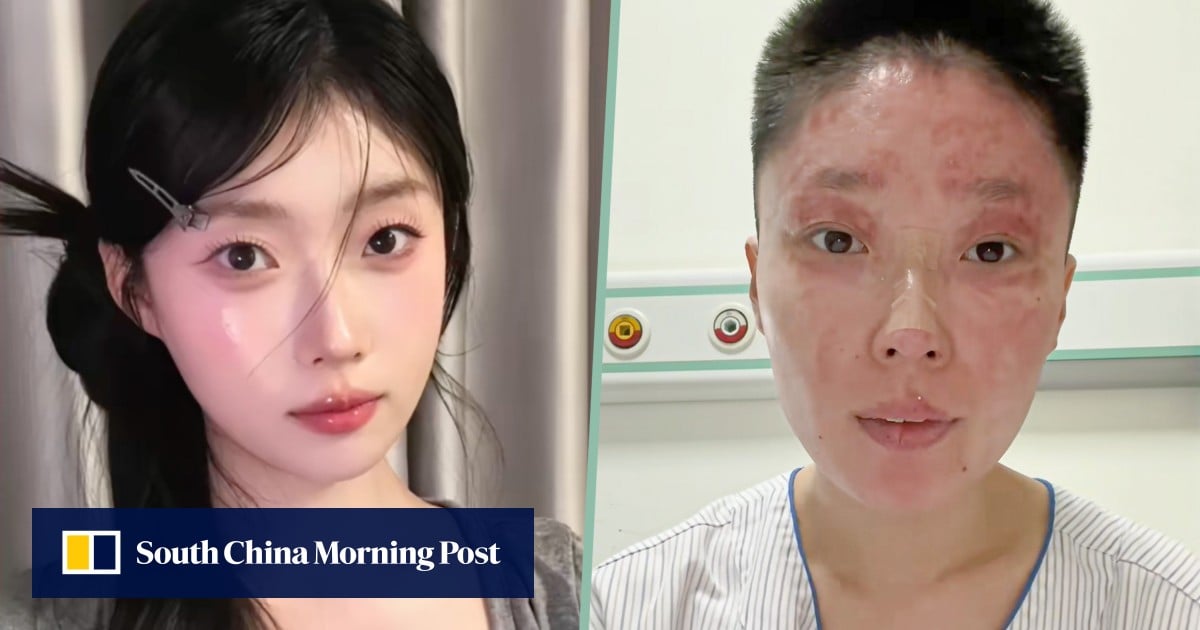 https://cdn.i-scmp.com/sites/default/files/styles/og_image_scmp_generic/public/d8/images/canvas/2025/09/17/c59ccbb9-c028-4e0e-80f7-73678dad3290_77bf98dd.jpg?itok=ySomNC6j&v=1758103483