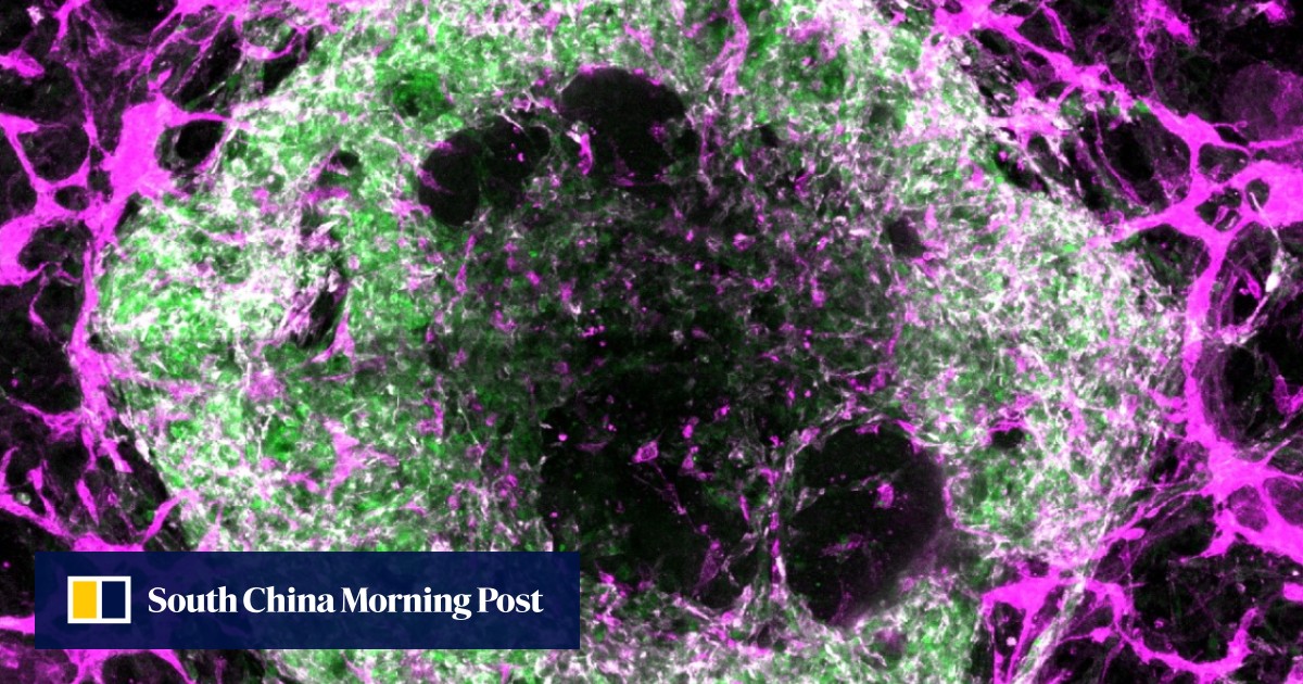 Breakthrough in lab-grown mini-organs shows promise for disease study