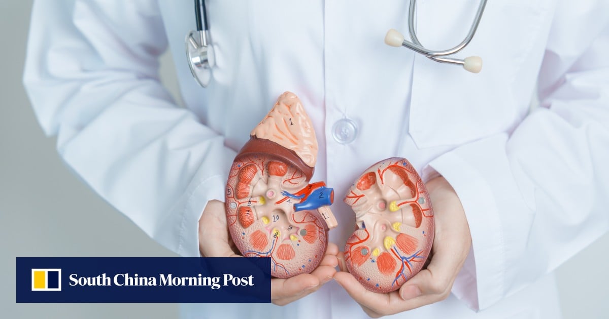 Beijing aids gold’s record run, kidney transplant first: SCMP daily highlights