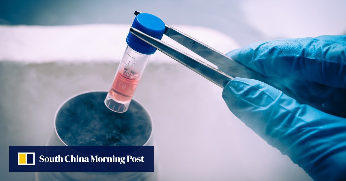 Chinese scientists develop promising stem cell therapy for Parkinson’s