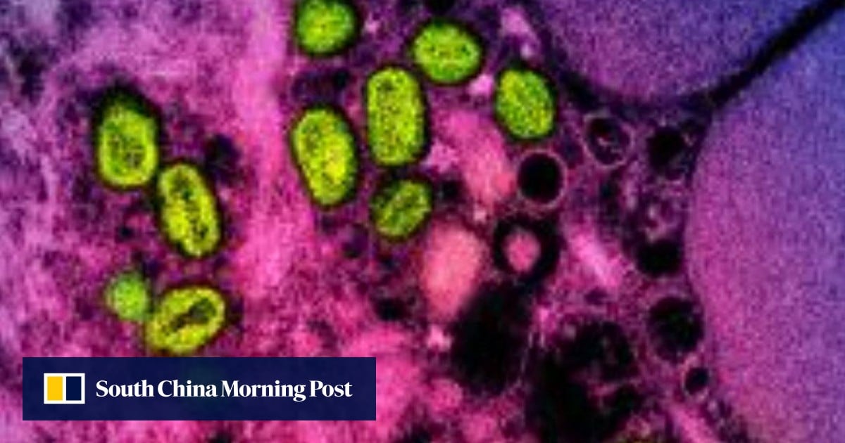 New mpox strain found in UK after travel to Asia