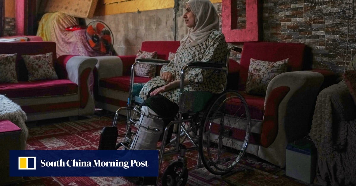 Gaza amputees desperate to walk again amid medical delays: ‘my future is paralysed’