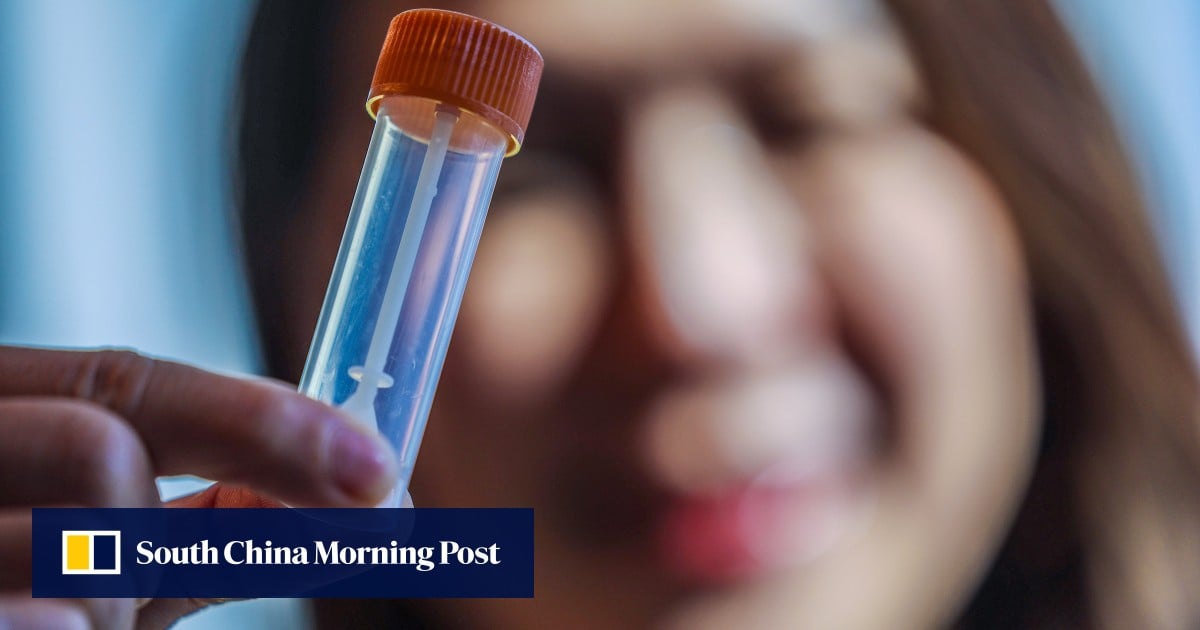 Chinese University of Hong Kong to offer free autism test for 200 young children