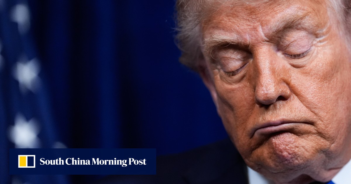 Trump blames bruised hand on aspirin, denies falling asleep in meetings