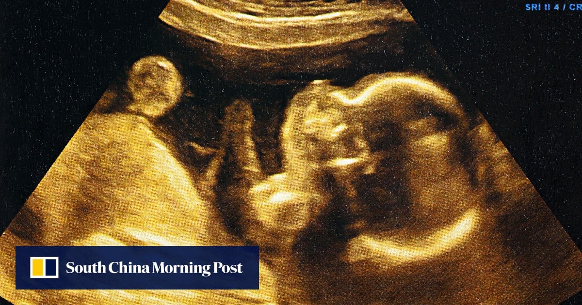China-led team replicates human embryo ‘invasion’ of the womb for the first time