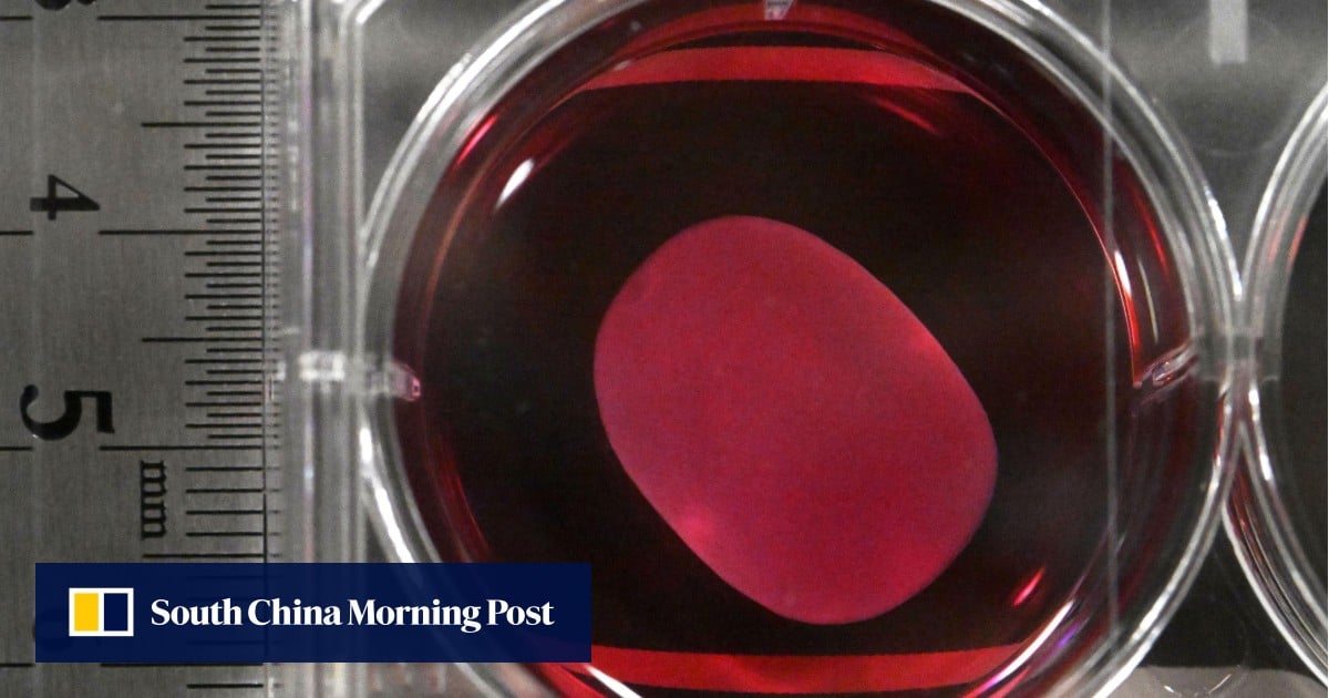 Japan approves world first regenerative medicines using iPS cells