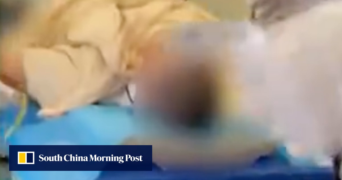 Self-styled China doctors nabbed for performing ‘bloodletting therapy’ to ‘remove’ evil energy