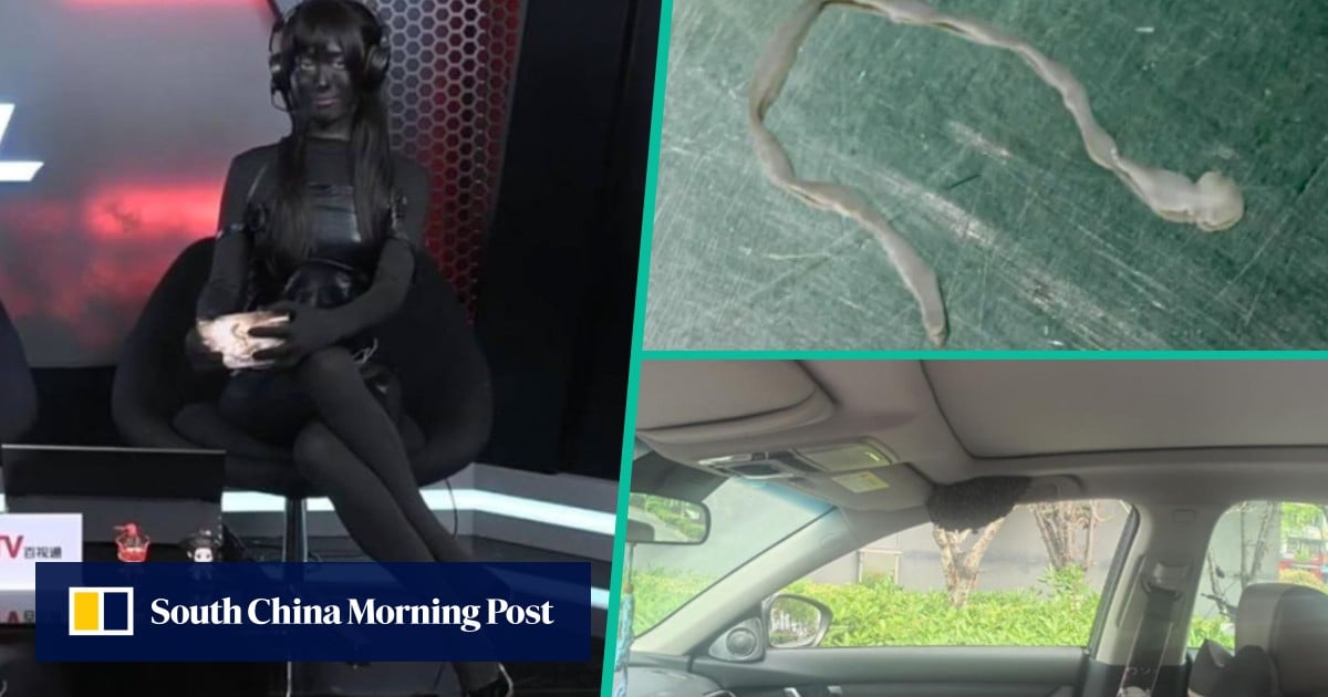 Quirky China: doctor removes worm from woman’s brain, under-fire gamer dyes her skin black