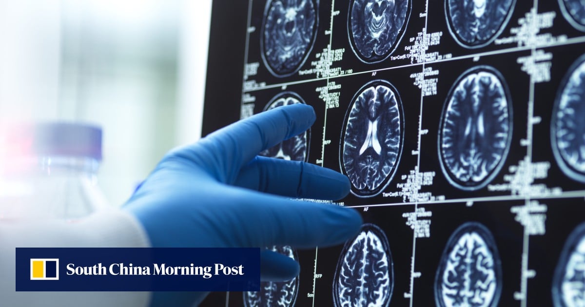 China launches war on Alzheimer’s that may affect 10 per cent of population by 2050