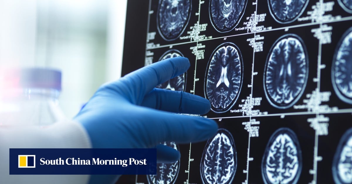 China builds world’s first ‘coal battery’, war on Alzheimer’s: 7 ...