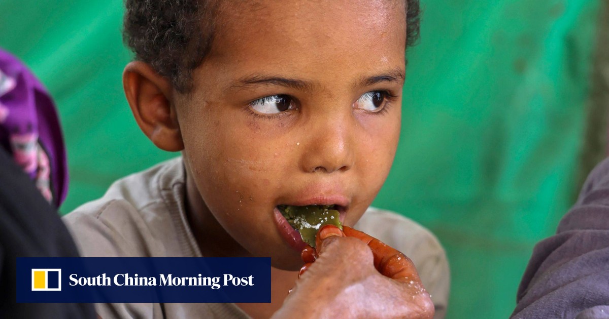 Yemen family eats tree leaves as aid dies out