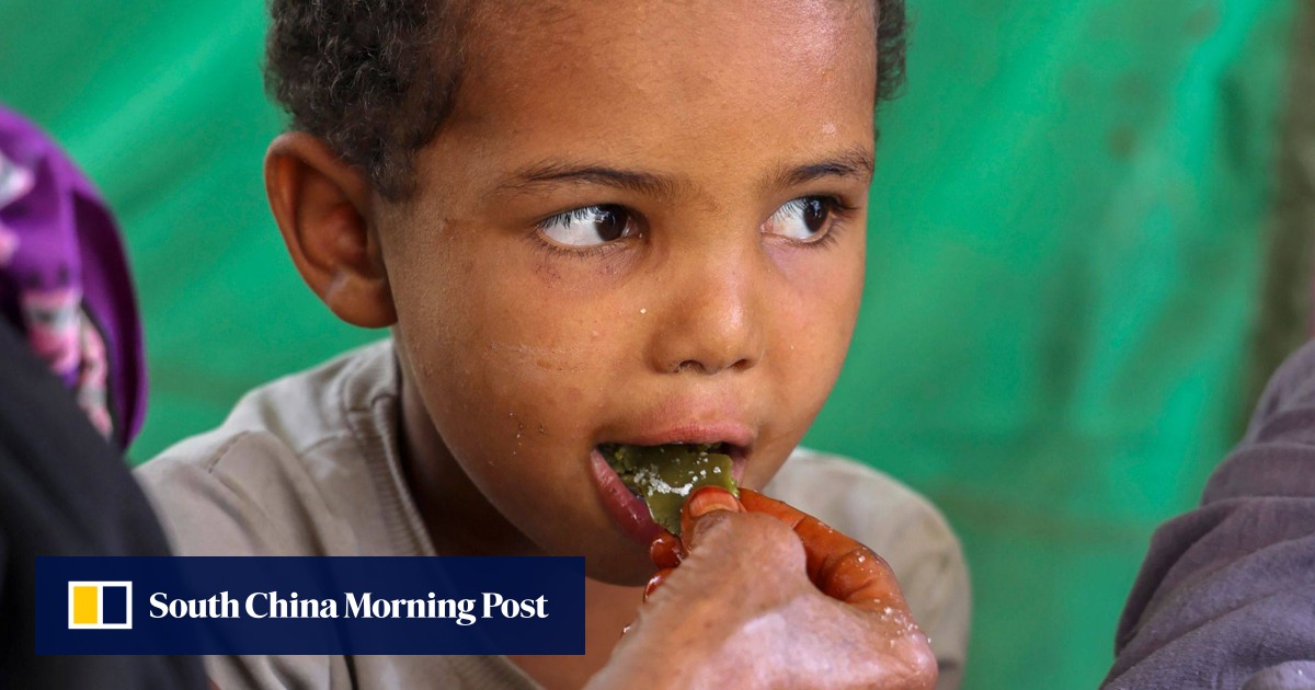 Yemen family eats tree leaves as aid dies out