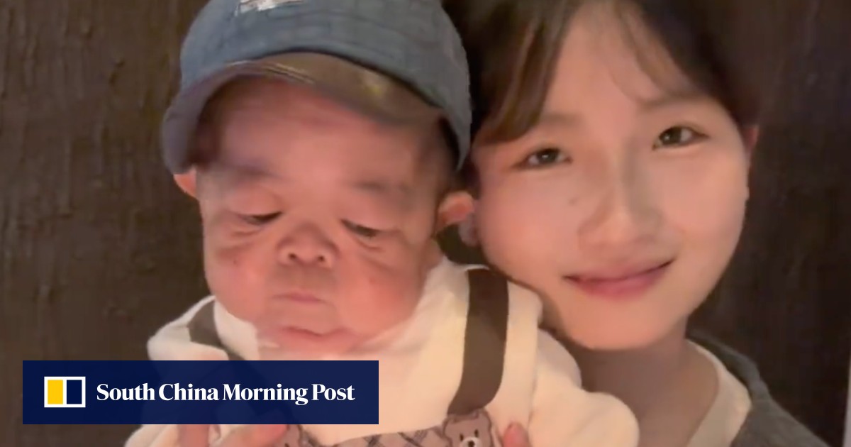 Baby-sized Chinese man, 25, goes viral online after younger sister shares caregiving journey