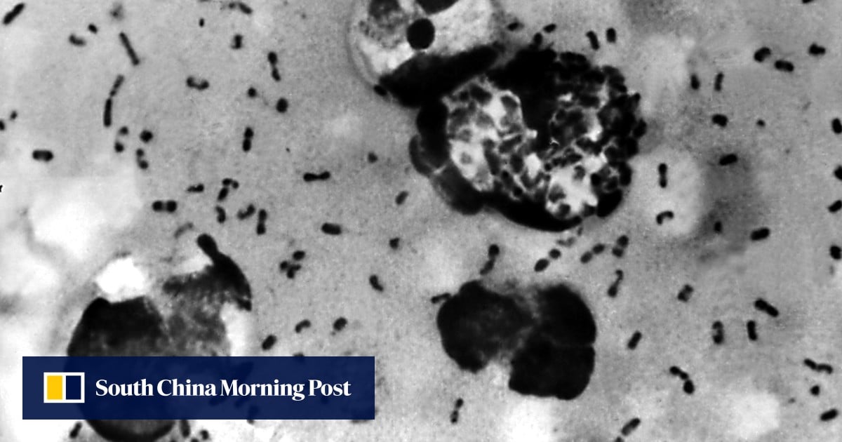 Our ancient enemy: scientists discover oldest-known plague outbreak Our ancient enemy: scientists discover oldest-known plague outbreak