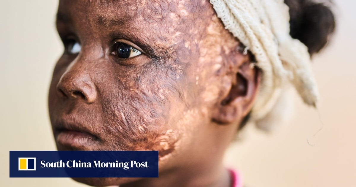 Sudan’s RSF committed ethnic cleansing, says Amnesty Sudan’s RSF committed ethnic cleansing, says Amnesty