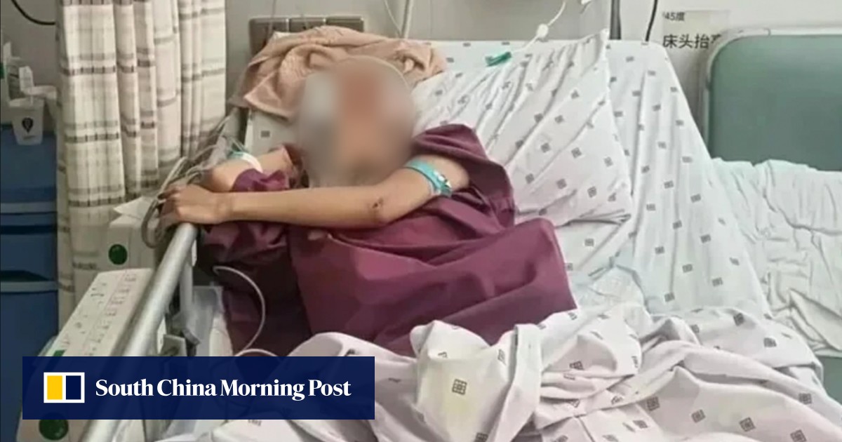 Chinese woman, 20, survives 18th floor ‘impulsive’ jump after argument with boyfriend