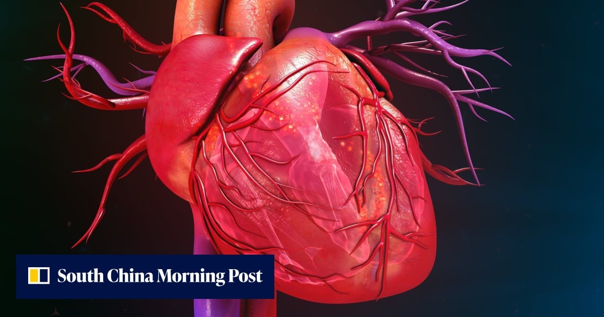 Chinese stem cell therapy reverses heart failure in 90% of patients in landmark trial