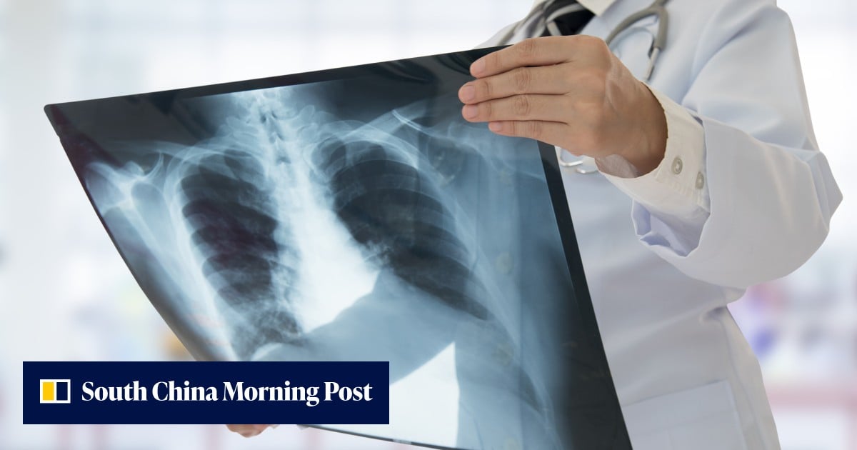 China team brings X-ray vision to life with a compact high-speed ghost video cam
