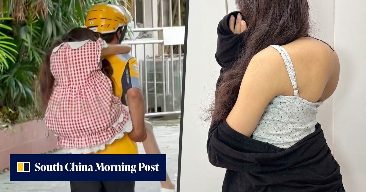 Chinese couple's surgery fundraising highlights how sudden fame ignites support, backlash