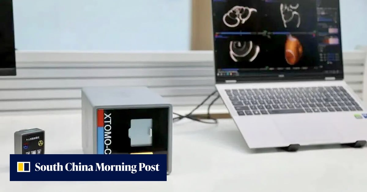 Chinese scientists build worldβs smallest CT scanner, weighing just 6kg - South China Morning Post
