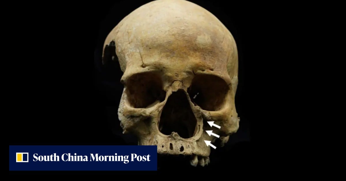 Chinese scientists find first evidence of ancient nose-chopping punishment for cattle thieves