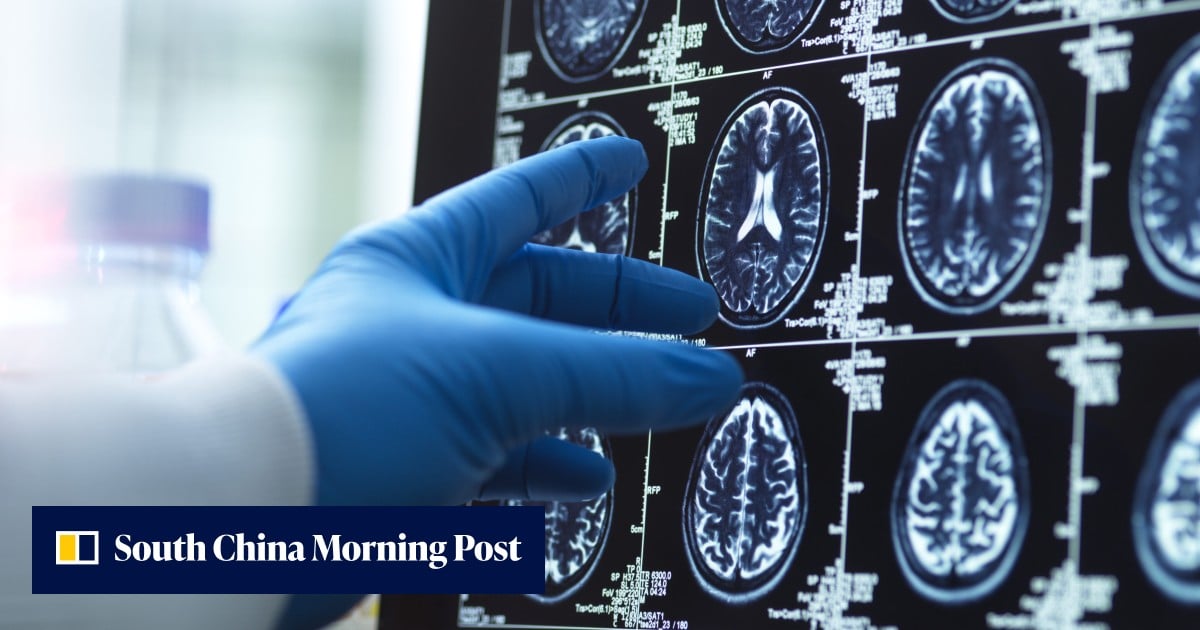 Japanese surgeon removes healthy brain tissue, leaving woman on ventilator