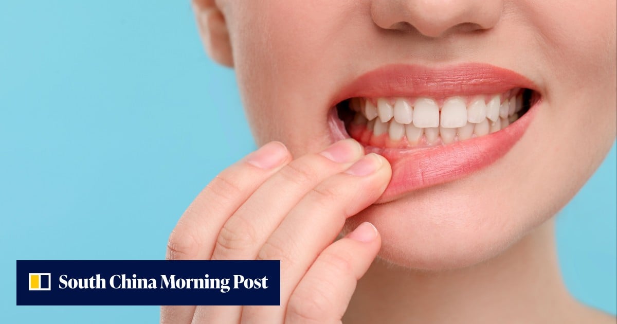 China trial shows gum tissue stem cells help 55% of lifetime diabetes patients