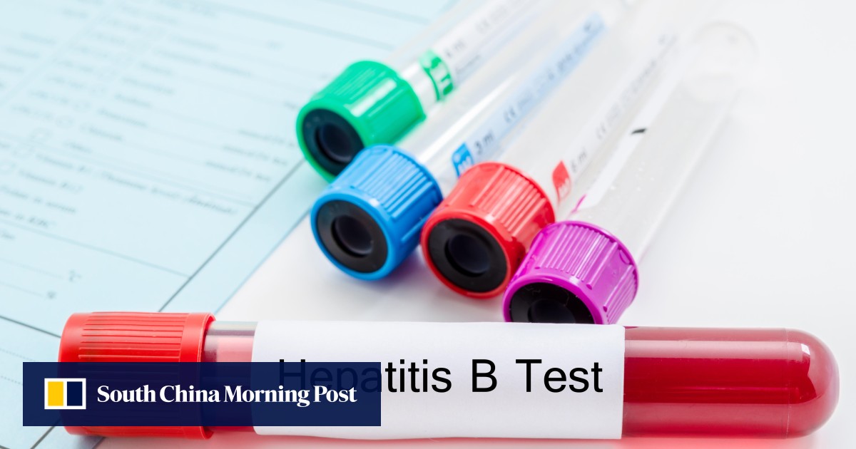 Hepatitis B cure research health organisations, patient groups