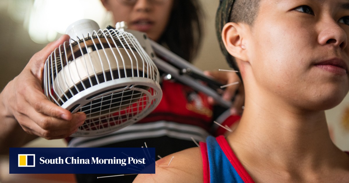 Acupuncture for athletes clinic uses Chinese medicine on sports