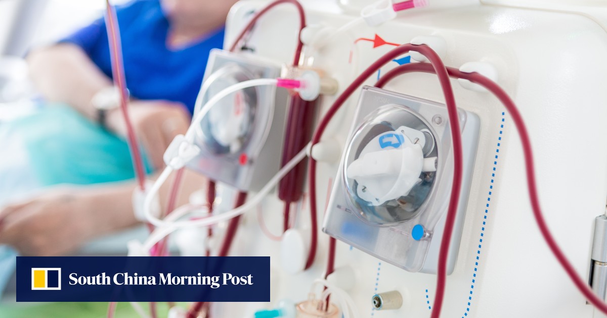 Singaporean startup’s portable ‘kidney’ could shrink dialysis machines, giving patients their