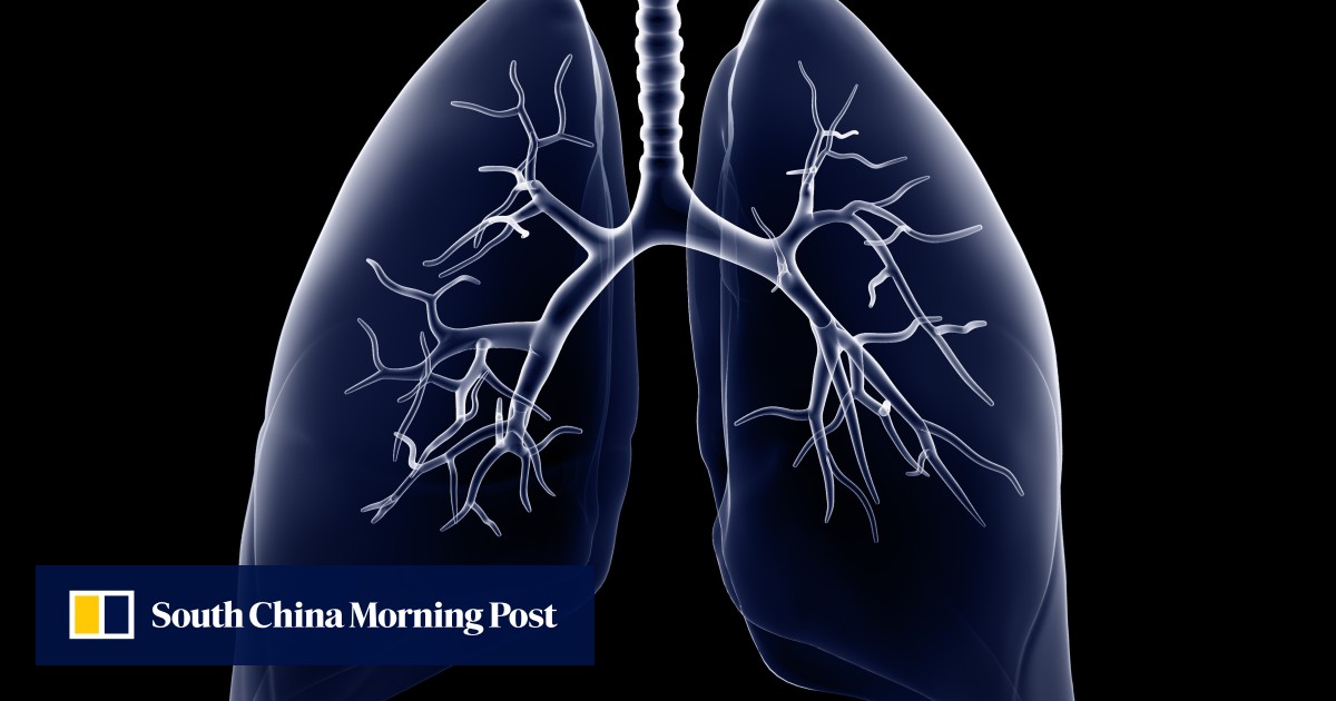 In What Way Are Our Lungs Forgiving South China Morning Post