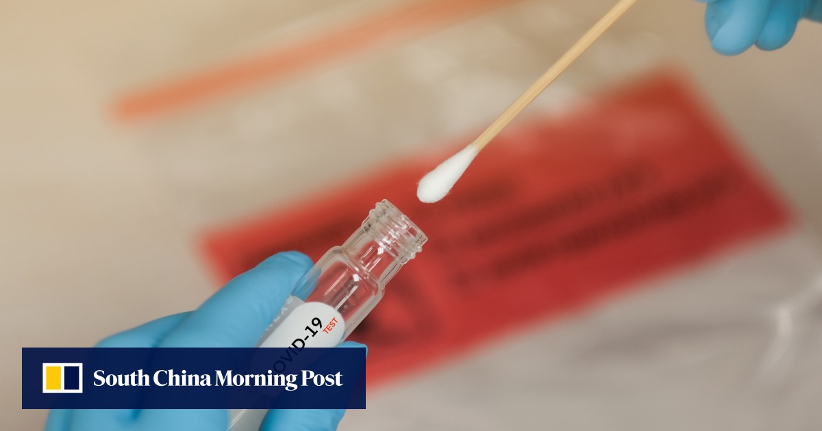 Coronavirus Philippines Apologises For Saying Chinese Test Kits Were Inaccurate South China Morning Post