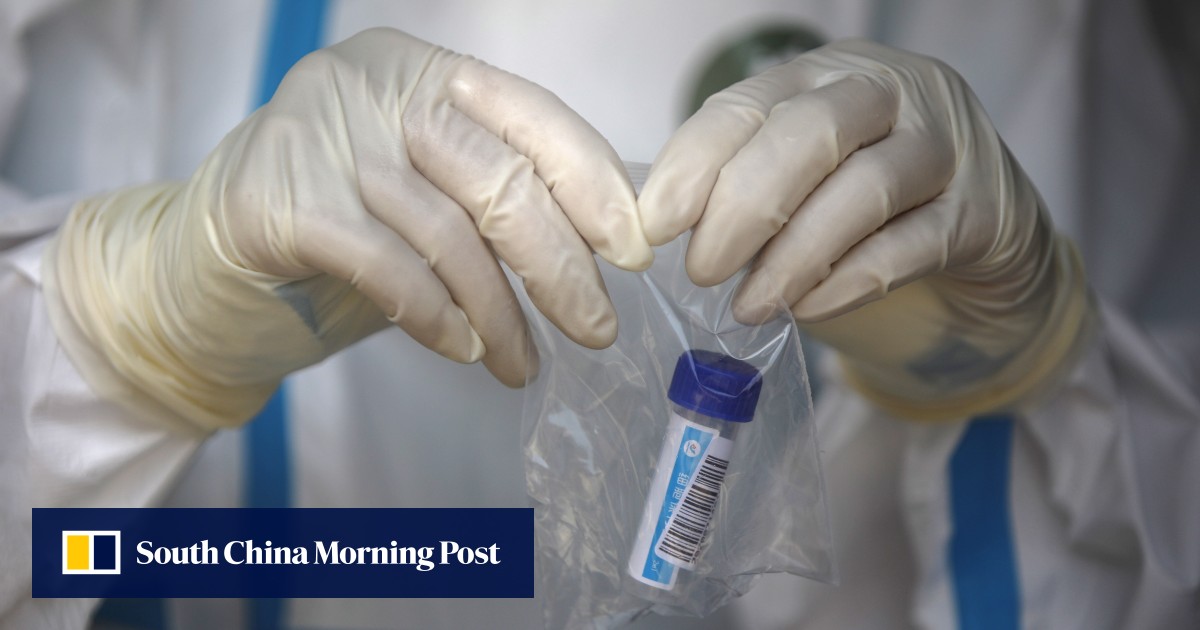 Could cells that fight common cold help people beat Covid-19? - South China Morning Post