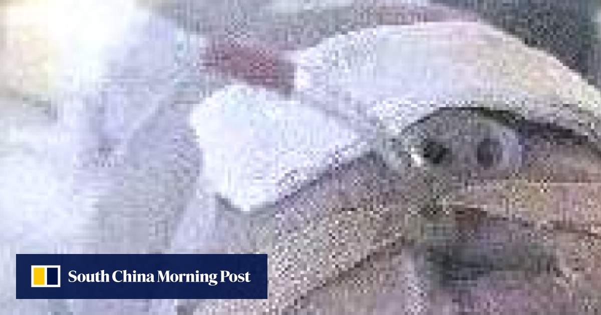 Chinese baby infected with tetanus after father cuts umbilical cord