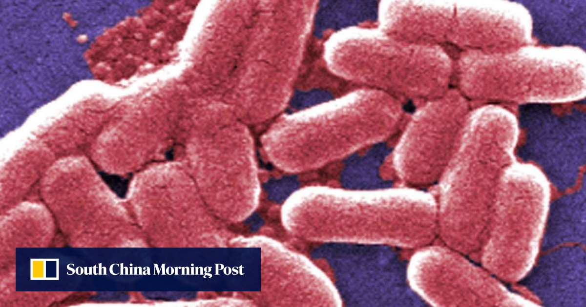 Infection experts warn of more US superbug cases in coming months ...