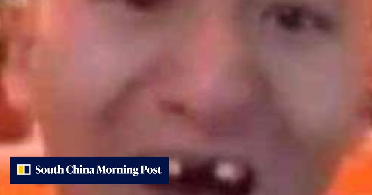 Chinese man loses two front teeth trying to eat raw corn on the cob off ...